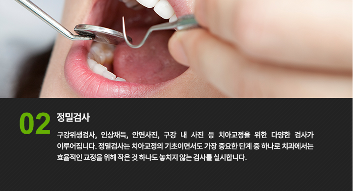 정밀검사 : 구강위생검사, 인상채득, 안면사진, 구강 내 사진 등 치아교정을 위한 다양한 검사가 이루어집니다. 정밀검사는 치아교정의 기초이면서도 가장 중요한 단계 중 하나로 core 치과에서는 효율적인 교정을 위해 작은 것 하나도 놓치지 않는 검사를 실시합니다.